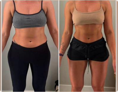 Frame 170-antes-e-depois