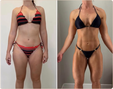 Frame 176-antes-e-depois