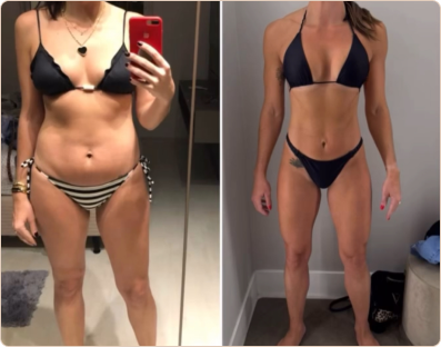 Frame 177-antes-e-depois