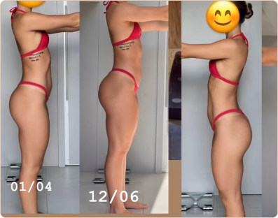 Frame 178-antes-e-depois