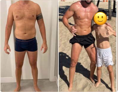 Frame 181-antes-e-depois