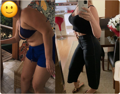 Frame 182-antes-e-depois