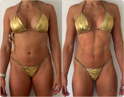 Frame 185-antes-e-depois