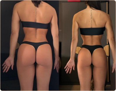 Frame 186-antes-e-depois