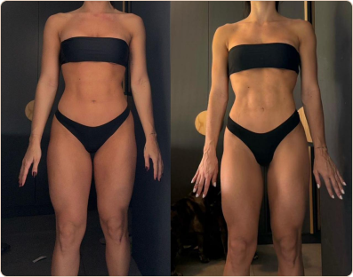 Frame 187-antes-e-depois