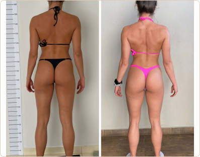 Frame 189-antes-e-depois