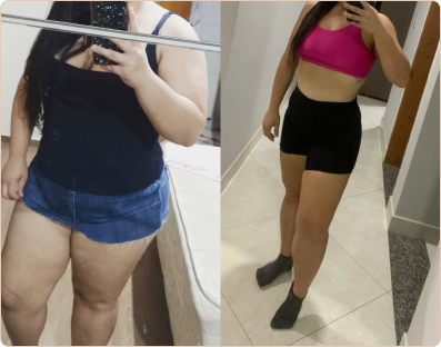 Frame 190-antes-e-depois