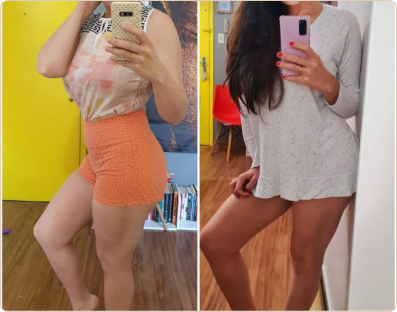 Frame 191-antes-e-depois