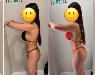 Frame 192-antes-e-depois